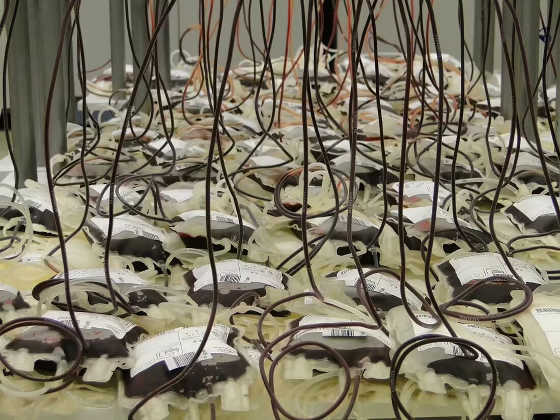 Im Bezirk Liezen spenden 3.873 Personen bis Oktober 2024 über 1.700 Liter Blut. Erfahren Sie mehr über die Kriterien, den Ablauf und kommende Termine für Blutspenden. Gemeinsam Leben retten!