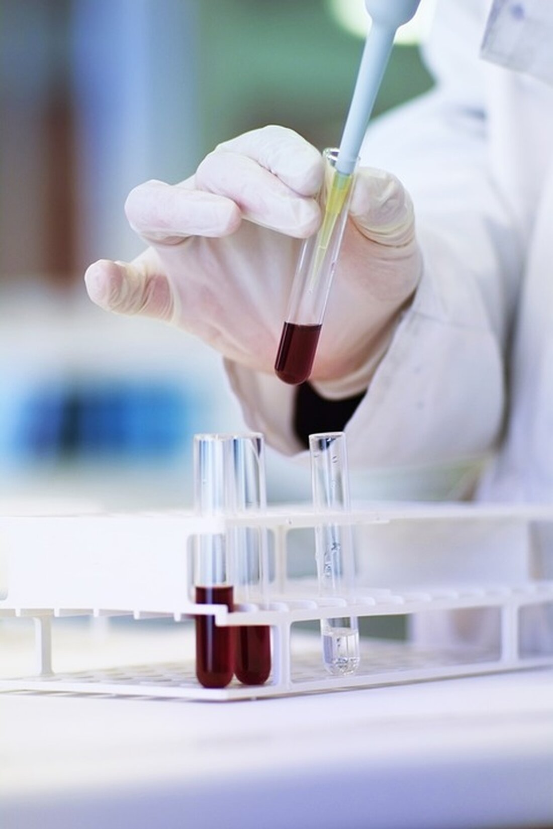Wissenschaftler der Chulalongkorn-Universität erkunden, wie Seideneiweiß zur gezielten Medikamentenabgabe eingesetzt werden kann. Diese innovative Methode könnte die Pharmakotherapie revolutionieren.
